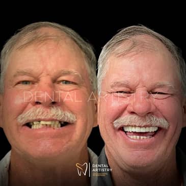 Slider image (8) Dental Artistry Dental Center